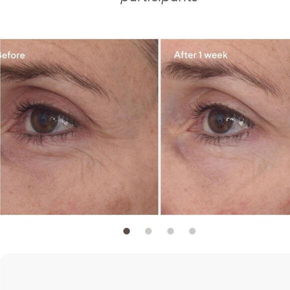 MURAD Retinal ReSculpt Eye Lift Treatment 15ml NEW IN BOX MSRP $92 - Picture 8 of 16